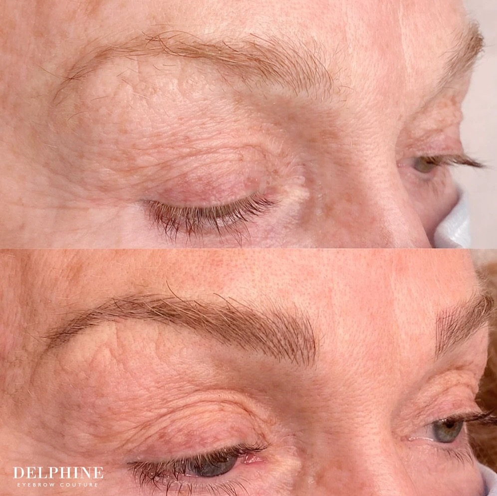 Eyebrow restoration by Delphine