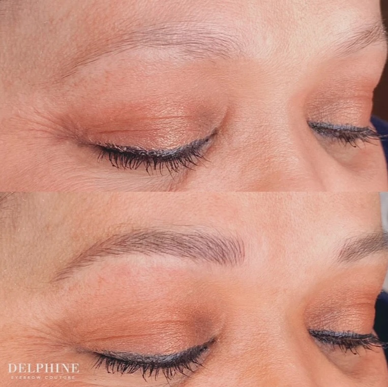 Eyebrow restoration by Delphine