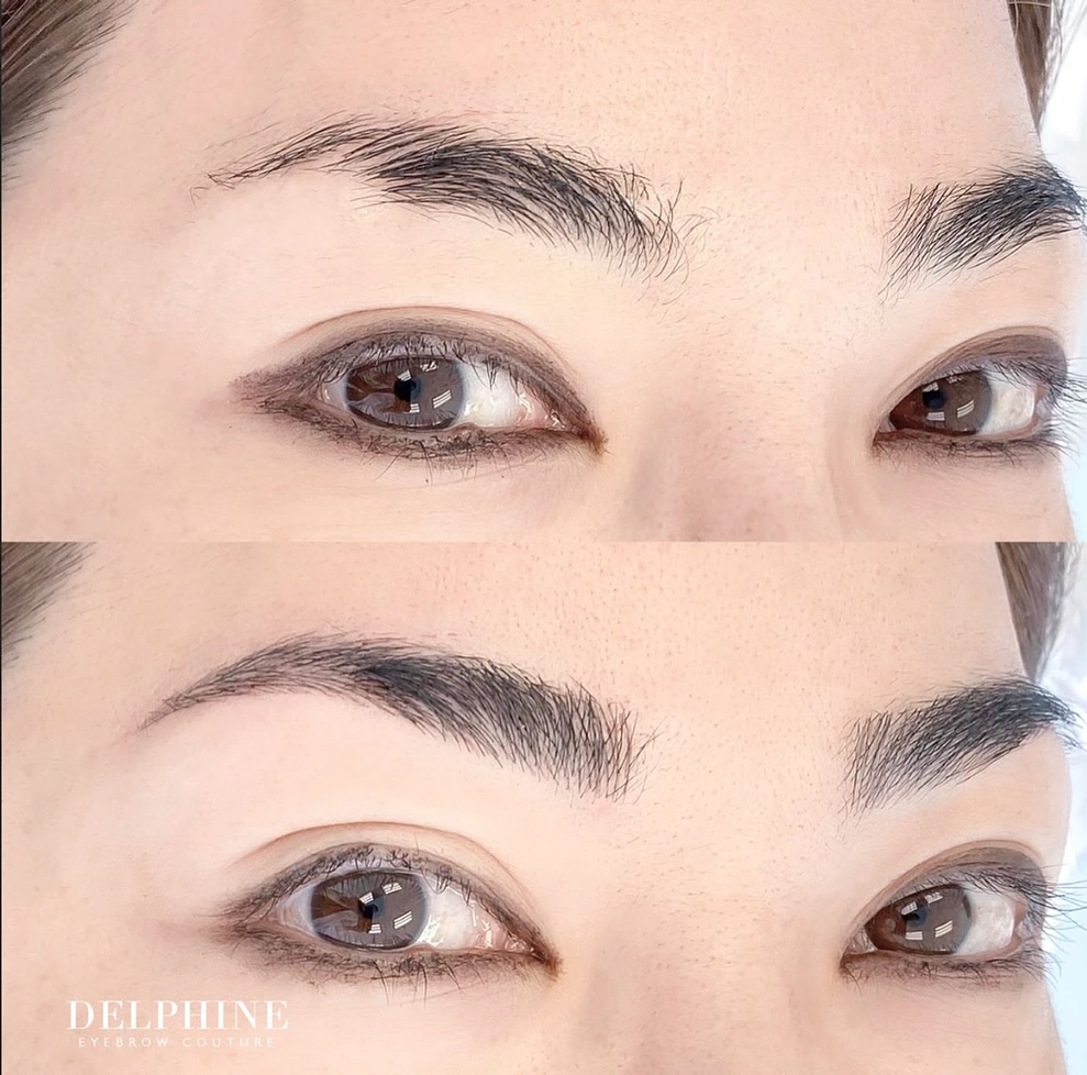 Eyebrow restoration by Delphine