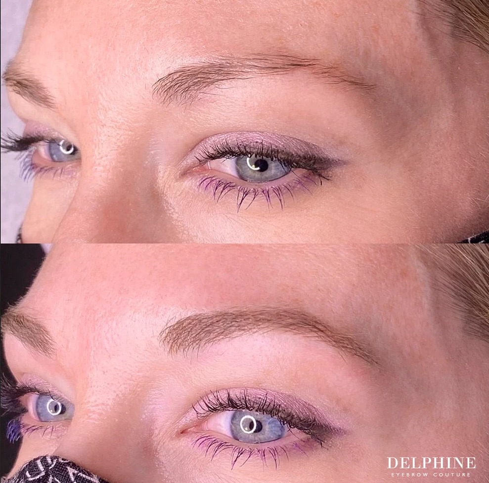 Eyebrow restoration by Delphine
