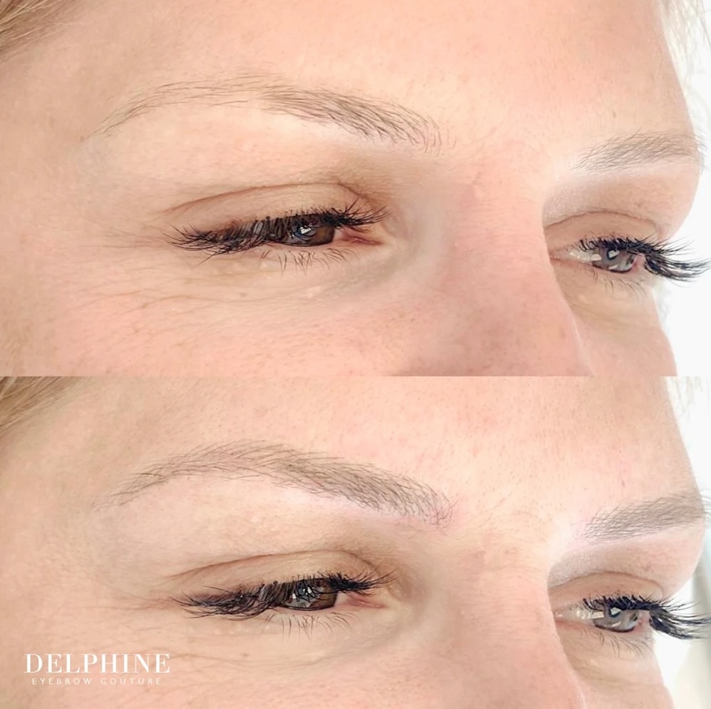 Eyebrow restoration by Delphine