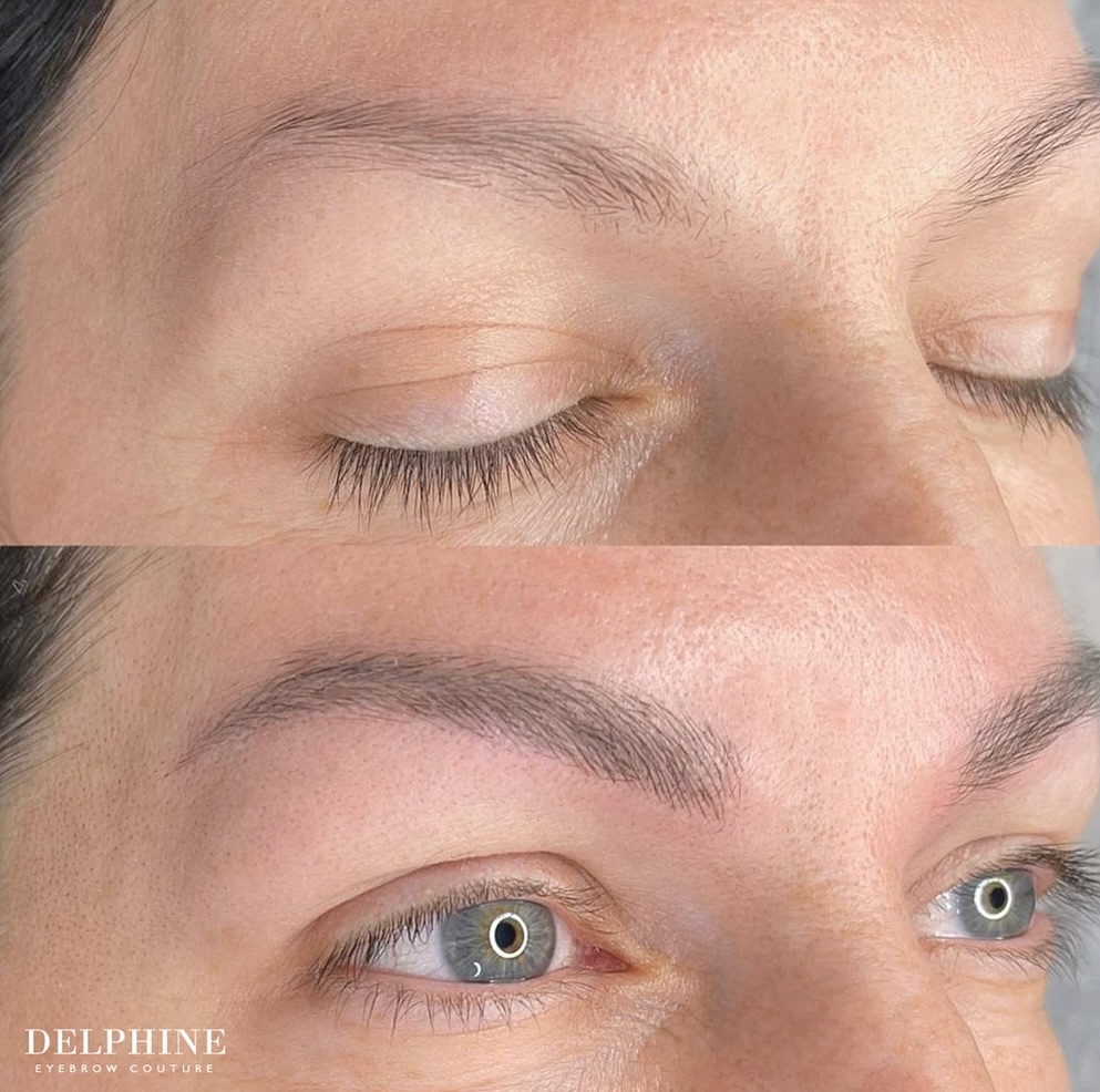 Eyebrow restoration by Delphine