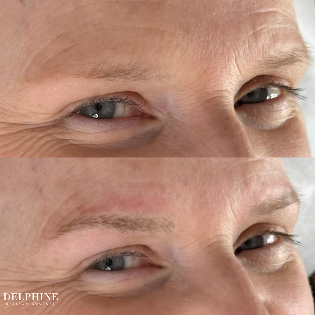 Eyebrow restoration by Delphine