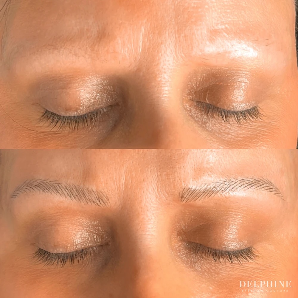 Eyebrow restoration by Delphine