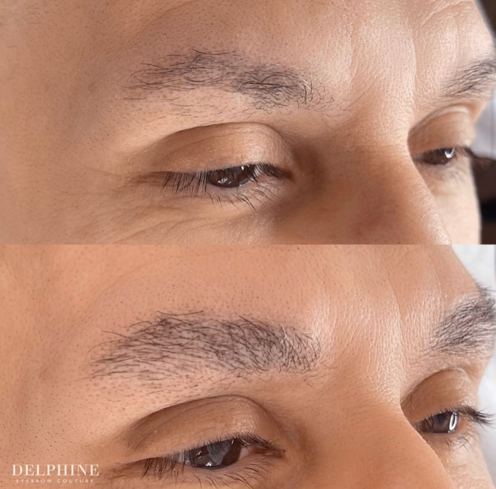 Eyebrow restoration by Delphine