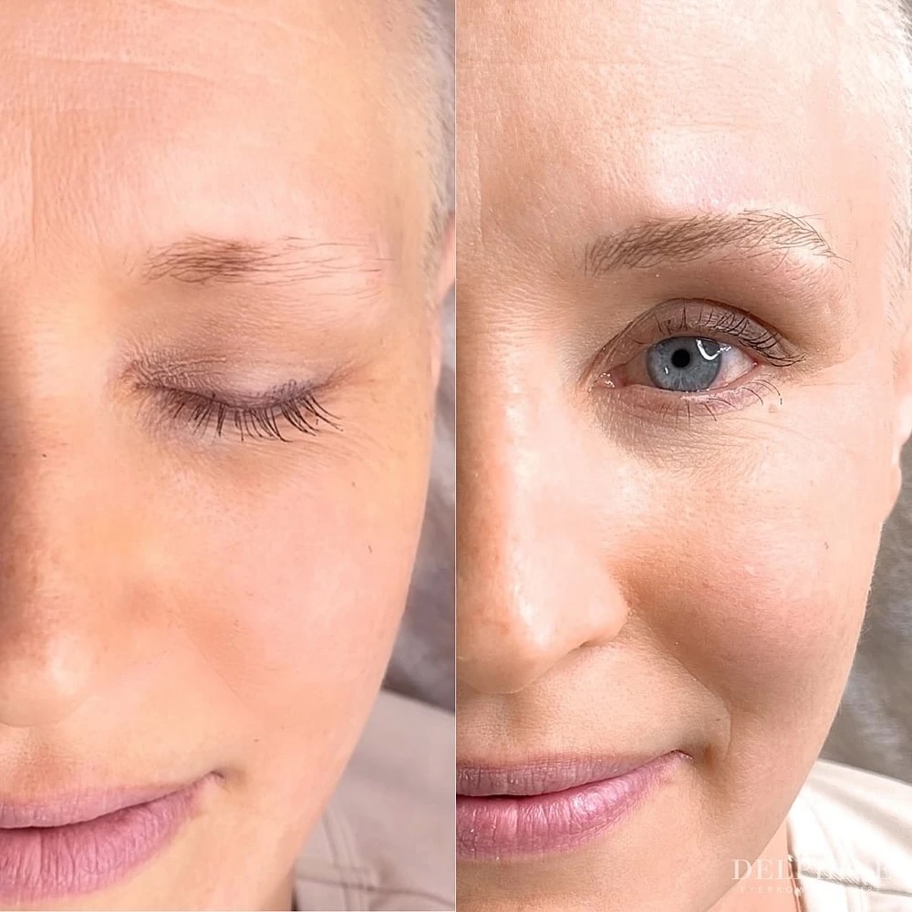Eyebrow restoration by Delphine