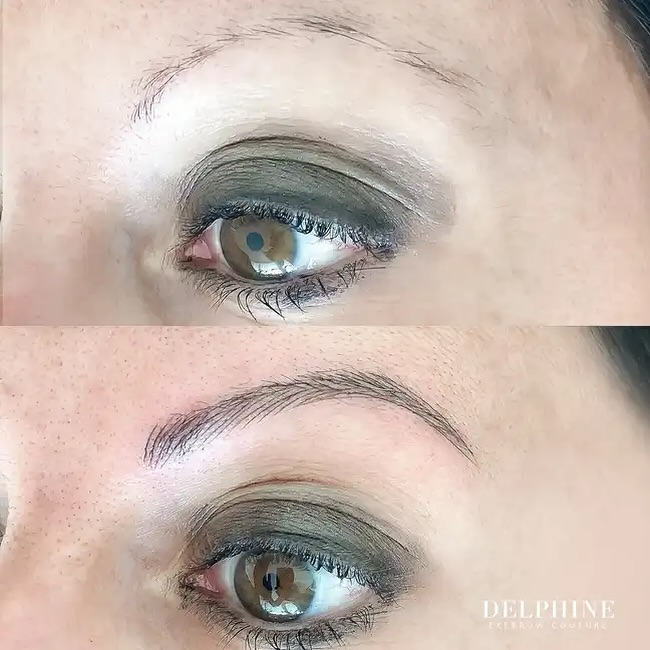 Eyebrow restoration by Delphine