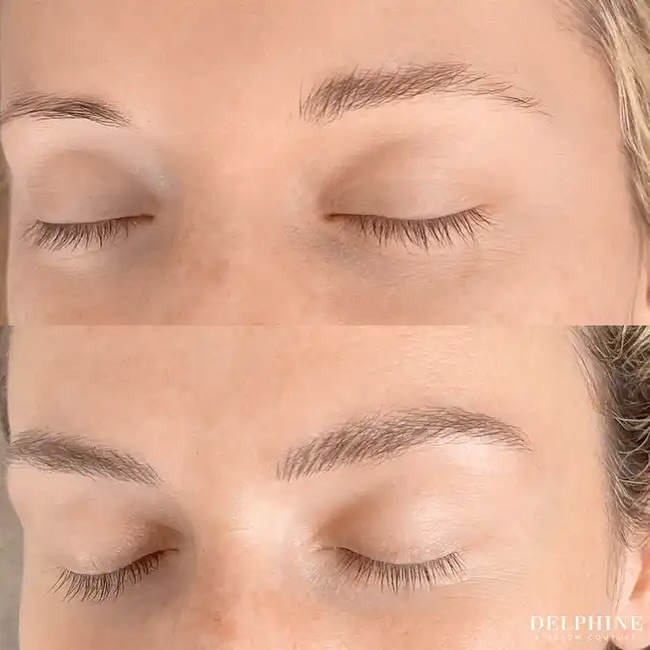 Eyebrow restoration by Delphine