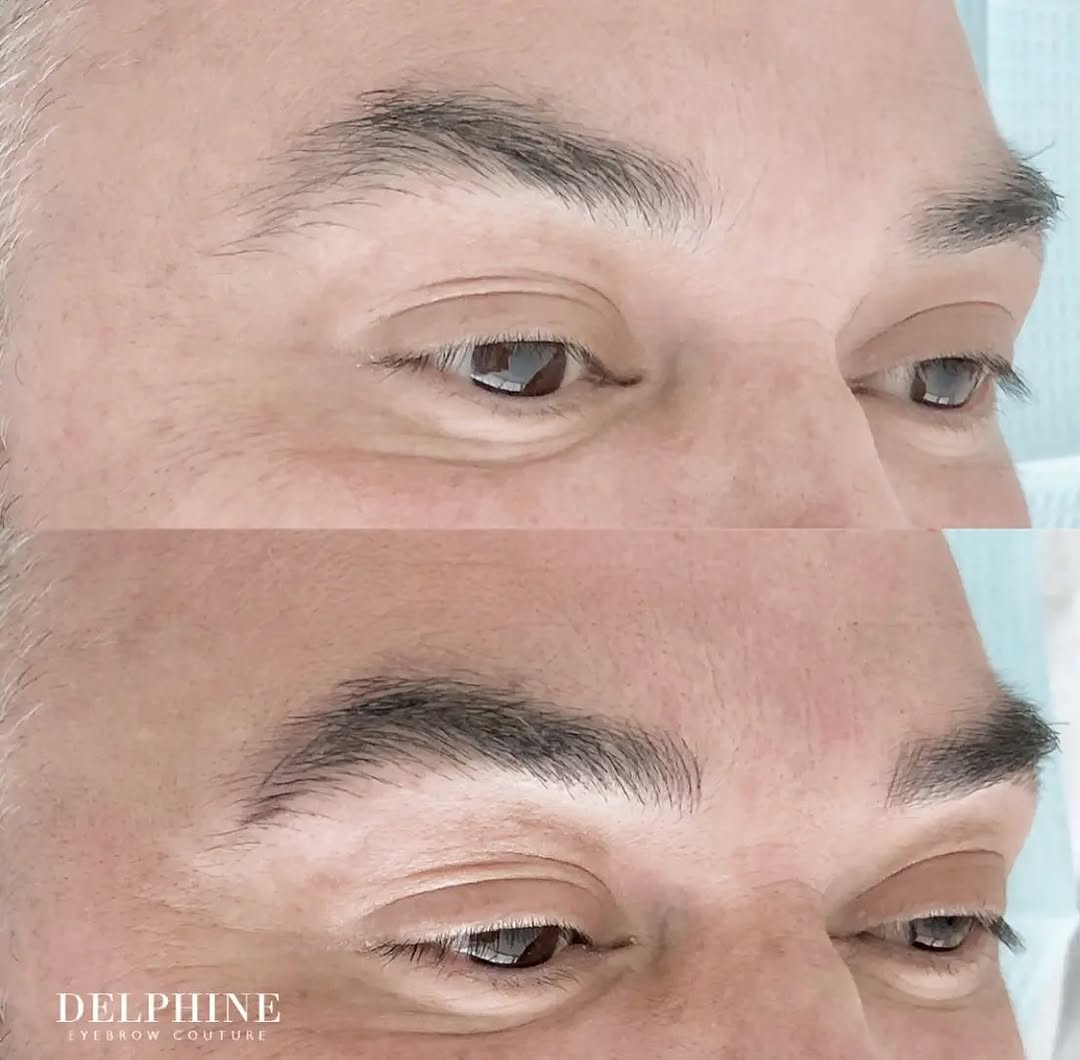 Eyebrow restoration by Delphine