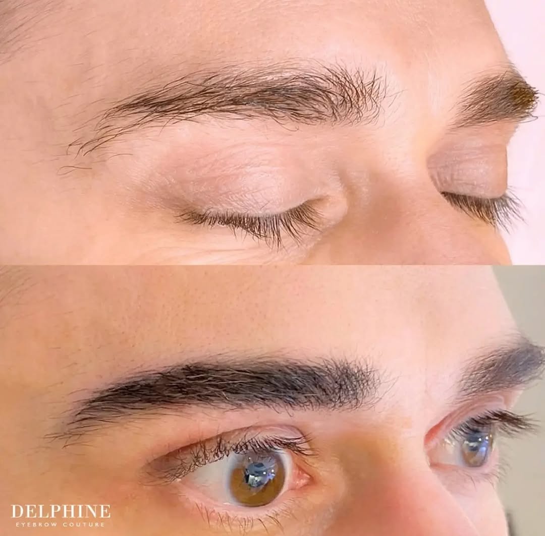 Eyebrow restoration by Delphine