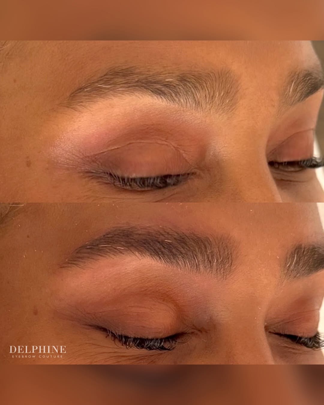 Eyebrow restoration by Delphine