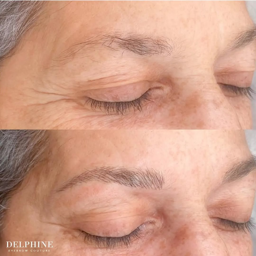 Eyebrow restoration by Delphine