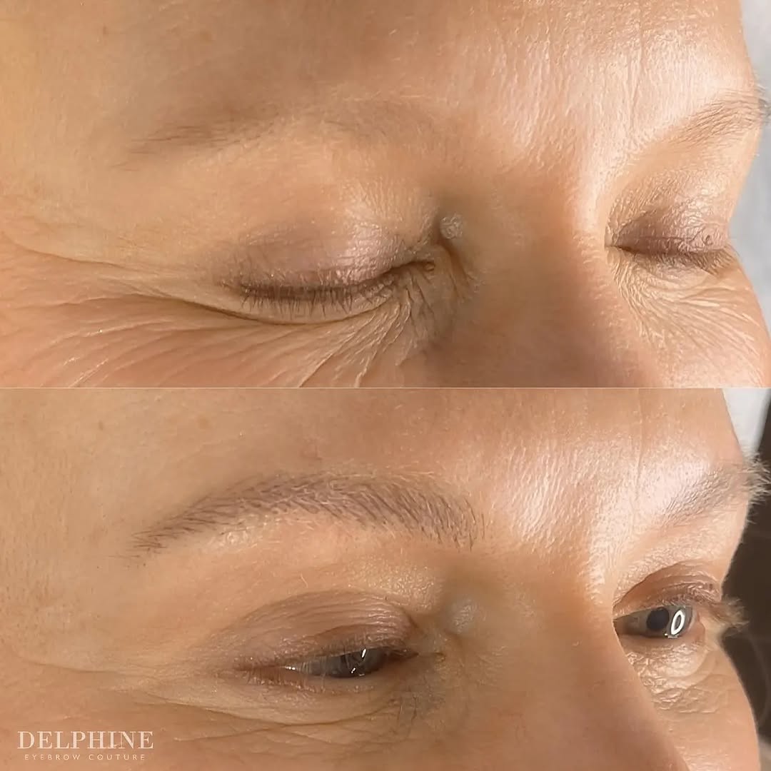 Eyebrow restoration by Delphine