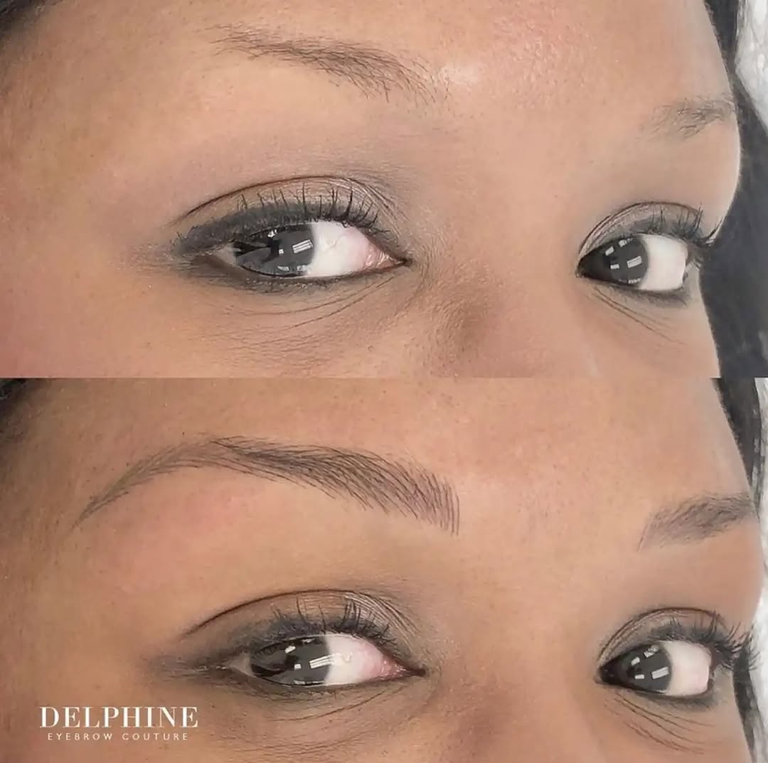 Eyebrow restoration by Delphine