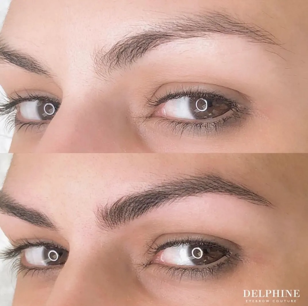 Eyebrow restoration by Delphine