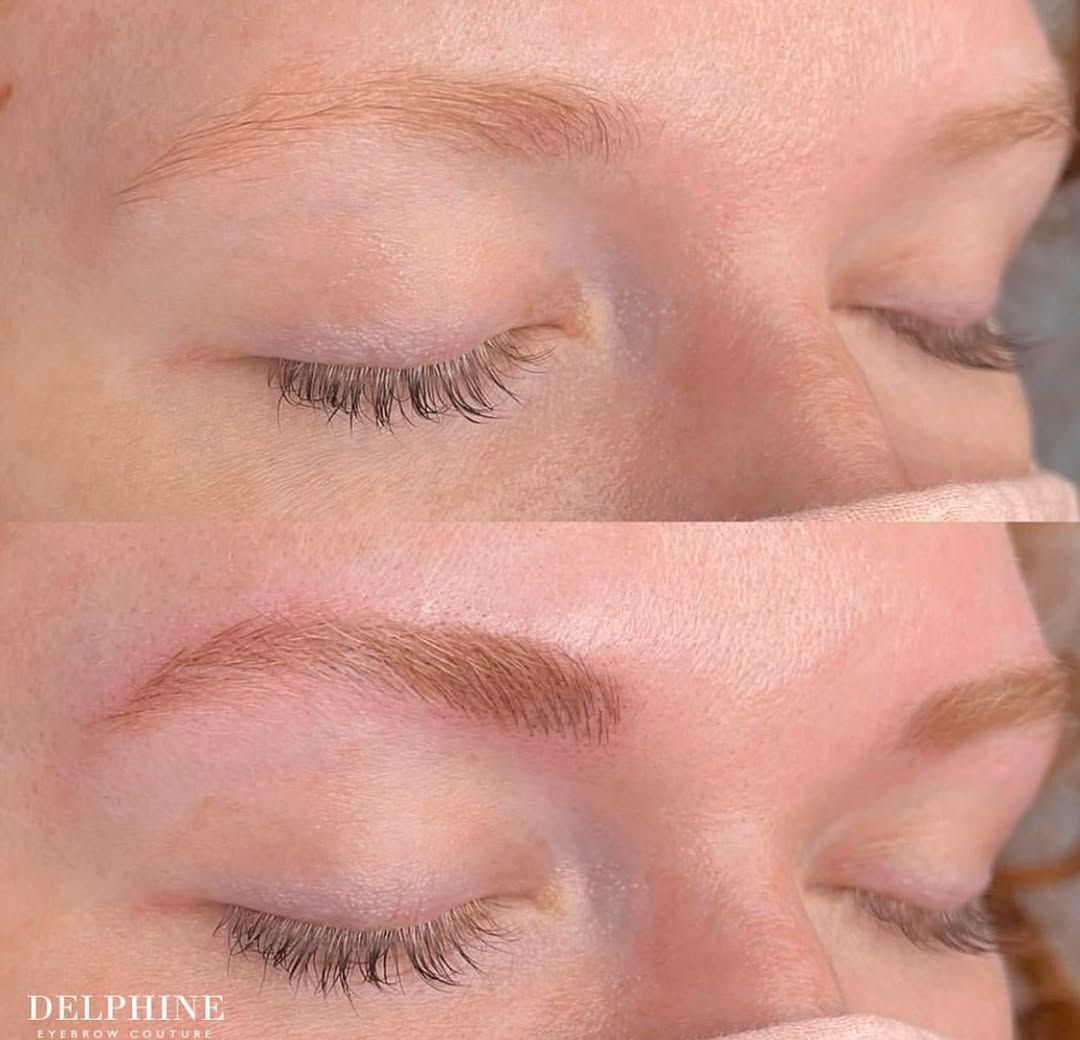 Eyebrow restoration by Delphine