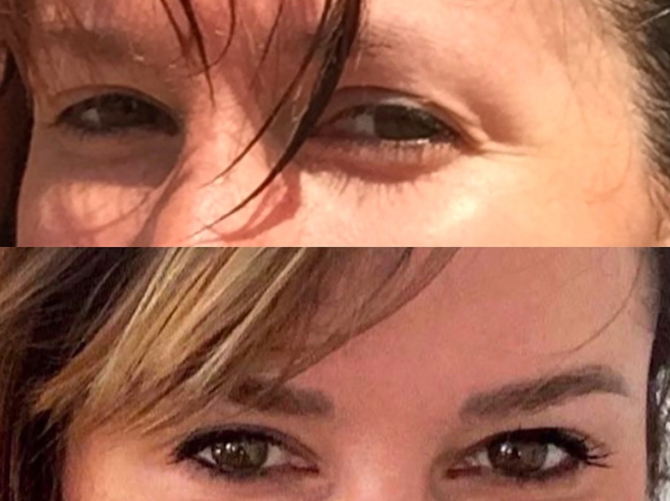 Eyebrow restoration by Delphine