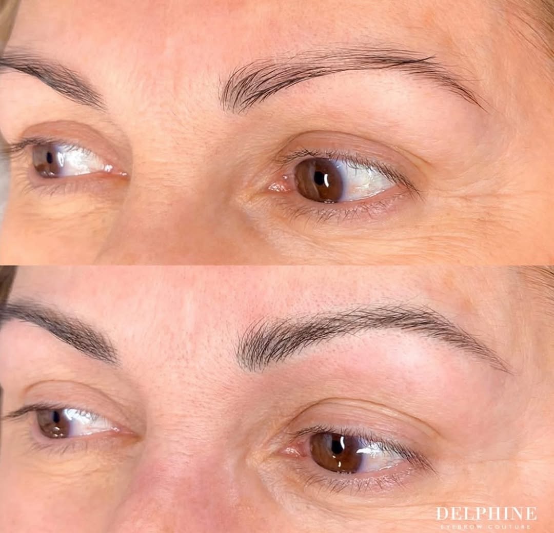 Eyebrow restoration by Delphine
