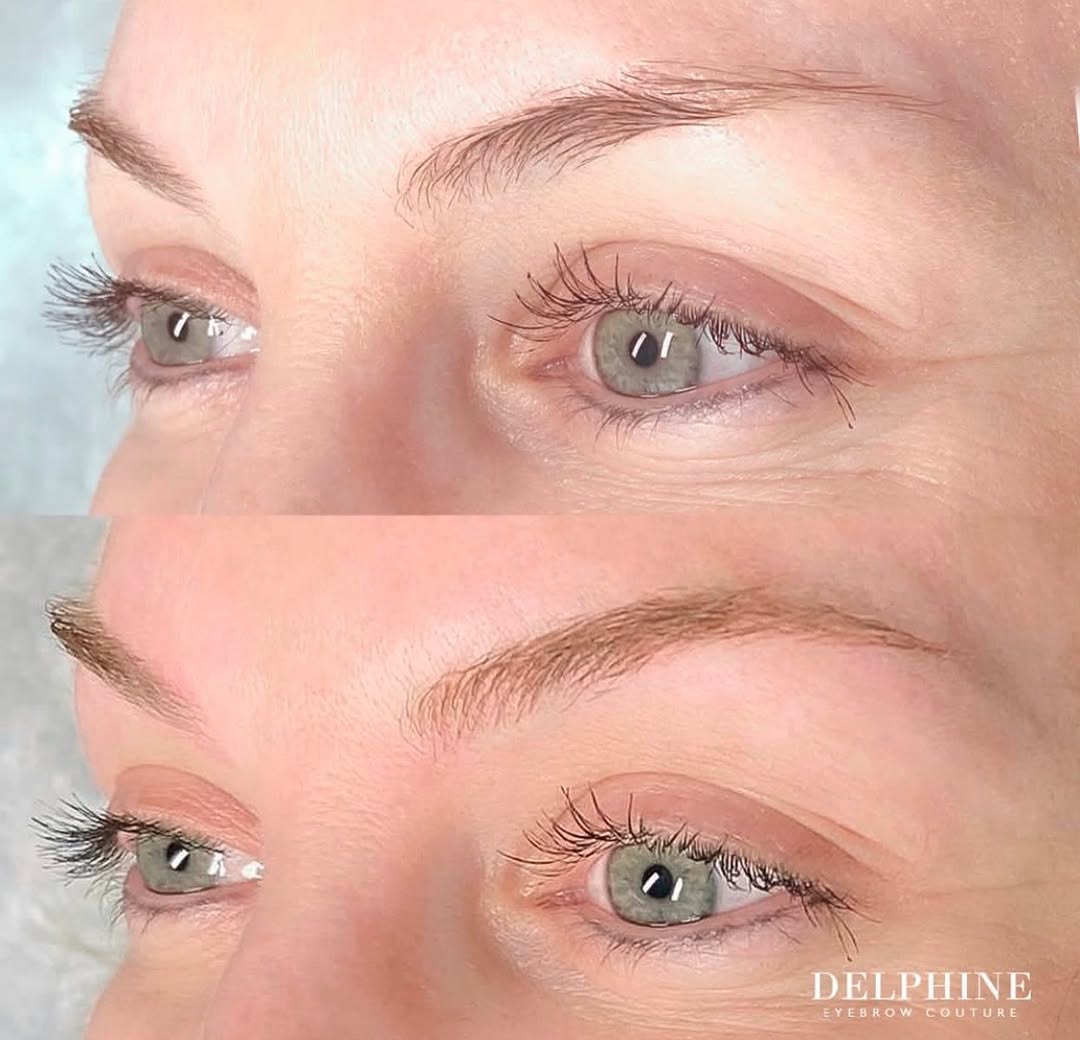 Eyebrow restoration by Delphine